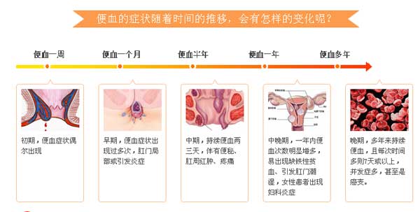 便血