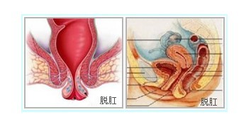 武汉博仕中医肛肠医院